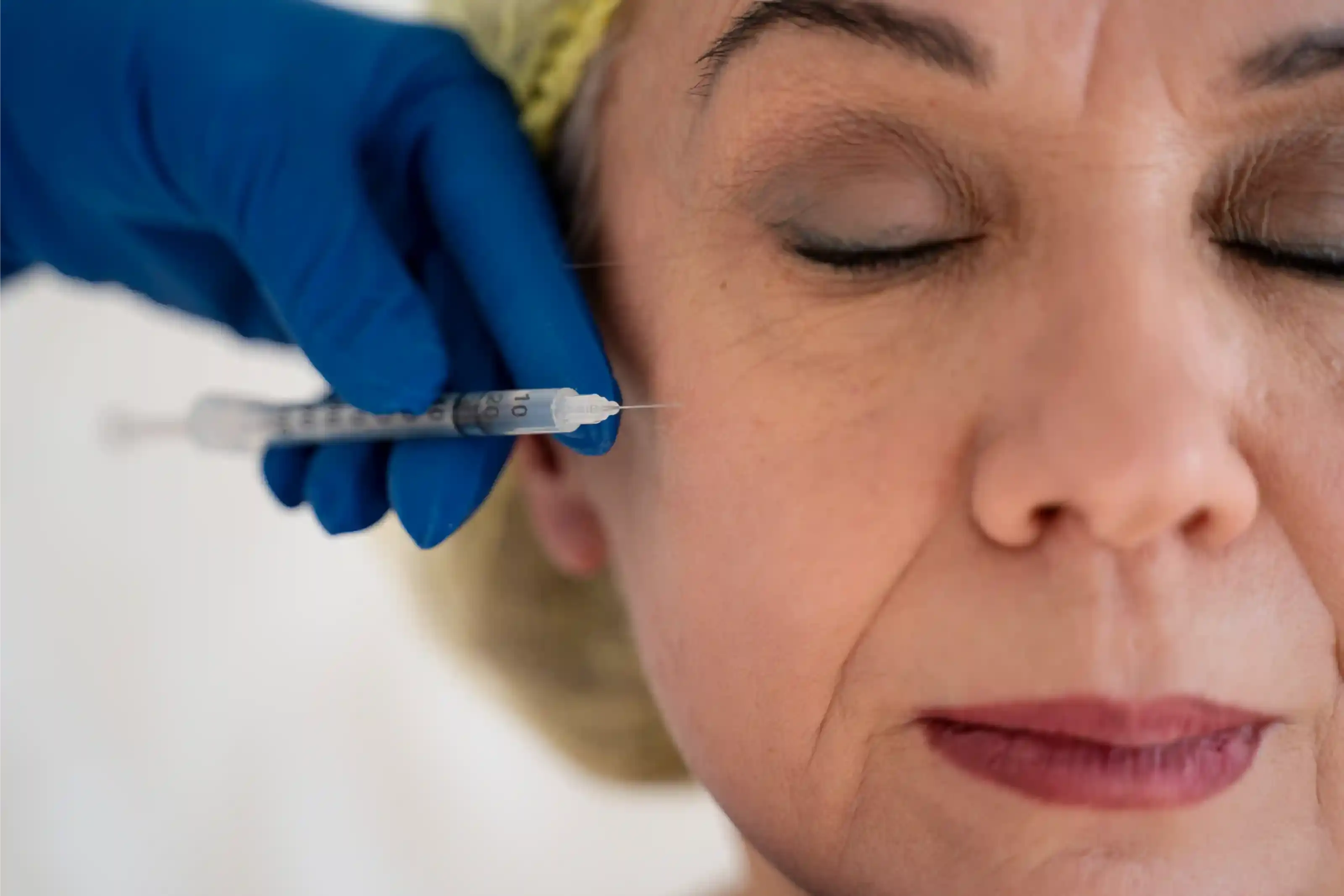 How Long Do Anti-Wrinkle Injections Last? Tips to Maximize Results